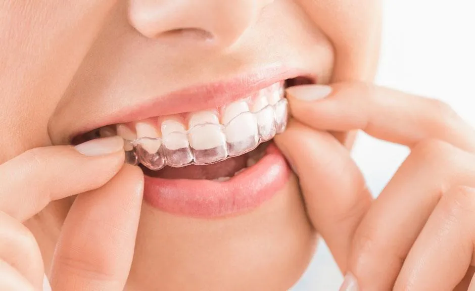 SureSmile clear aligner teeth straightening option