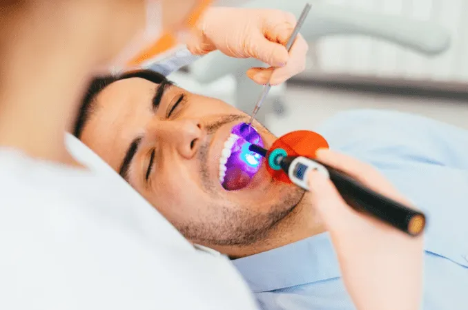 Dental Sealants: Pros and Cons for a Healthier Smile