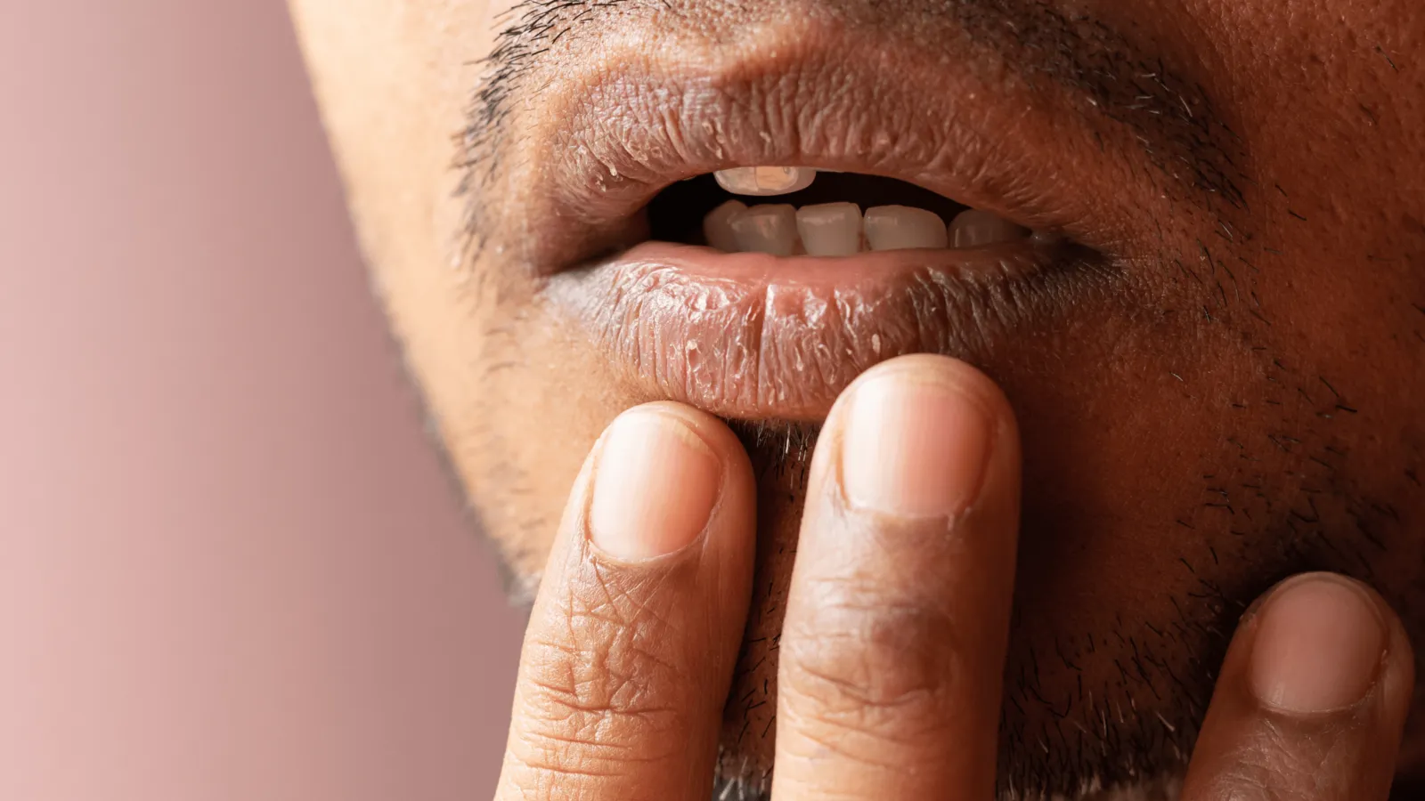 Woman wrapped in a warm blanket experiencing dry mouth during winter