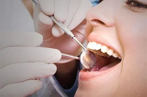 Dental cleaning tools used to keep gums healthy