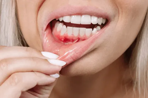 Illustration representing periodontal maintenance and gum health care