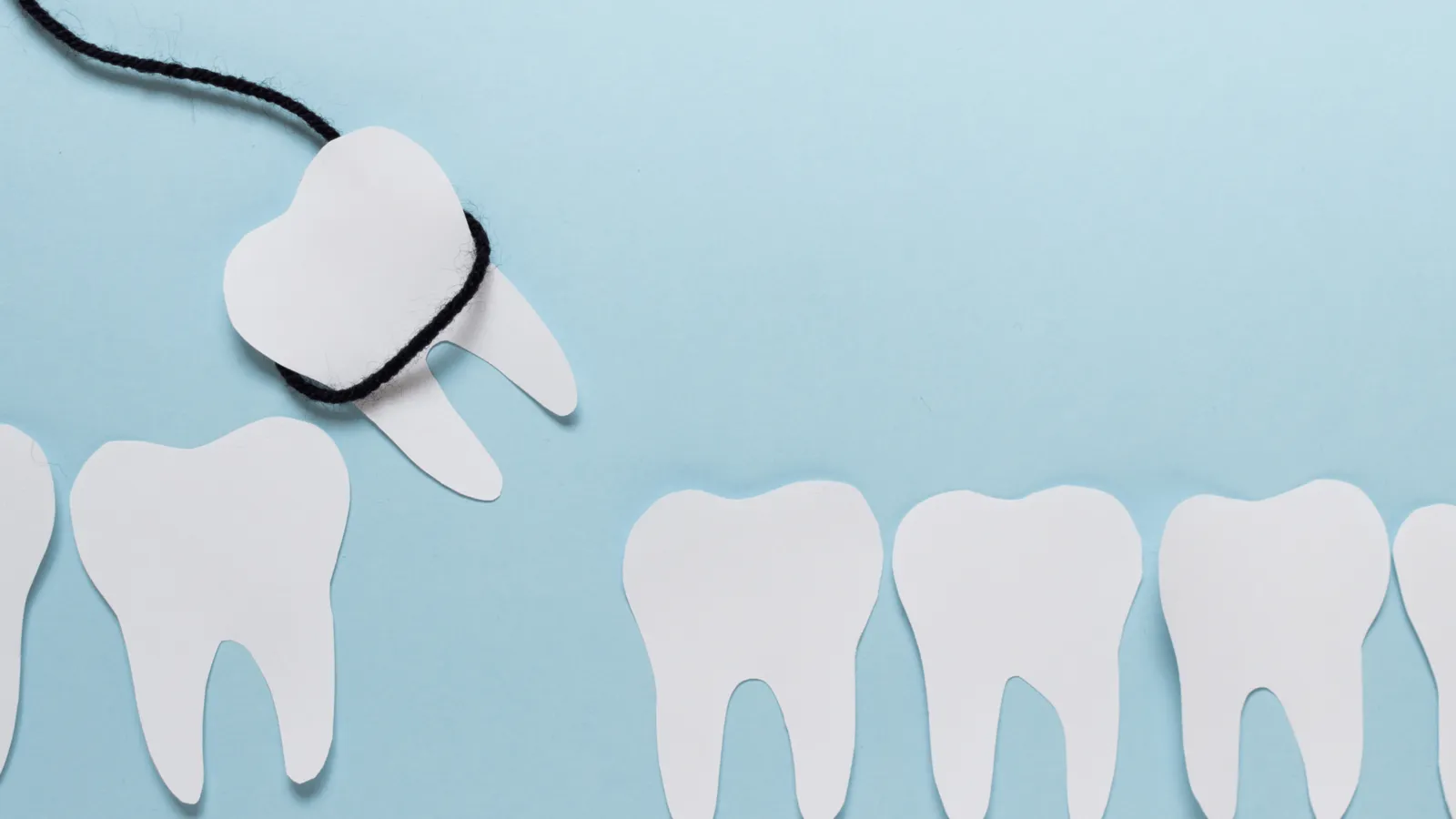Illustration representing tooth extraction recovery