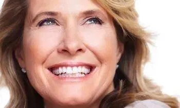 Before and after example of porcelain veneers