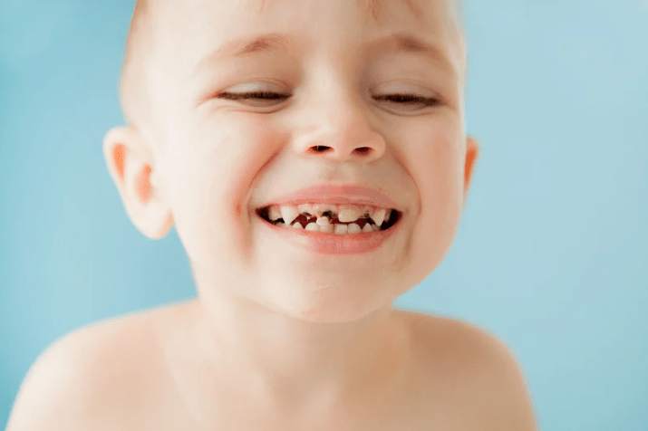 baby smiling at dentist