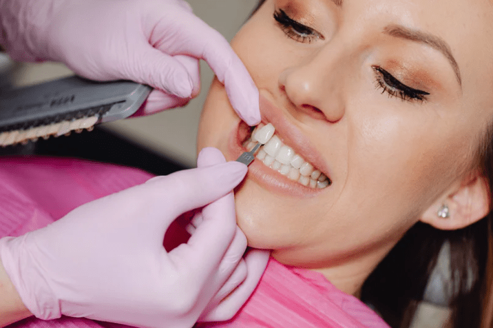 woman at dentist veneer