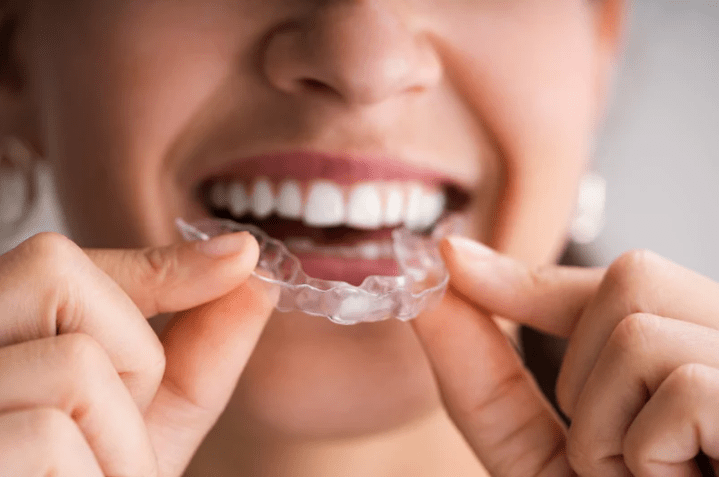 woman holding clear aligners