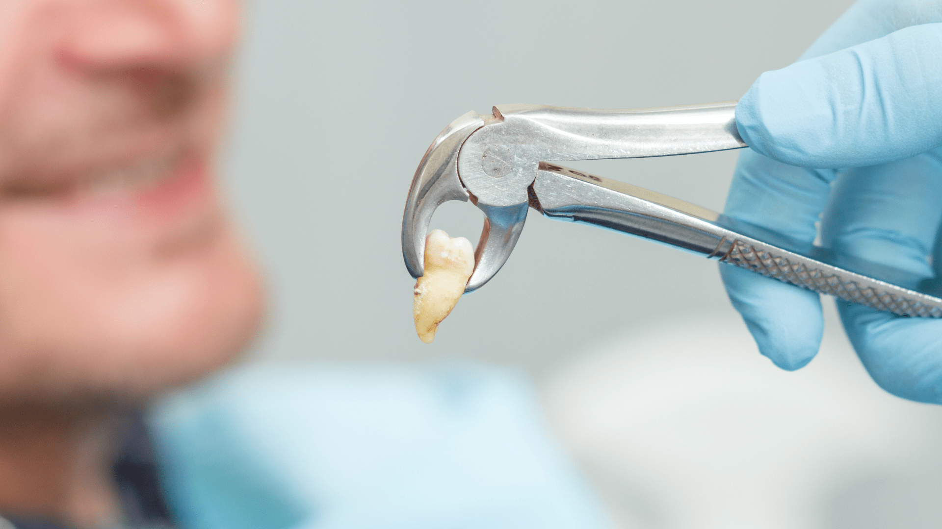 A Tooth Extraction