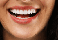 Cosmetic Dentistry