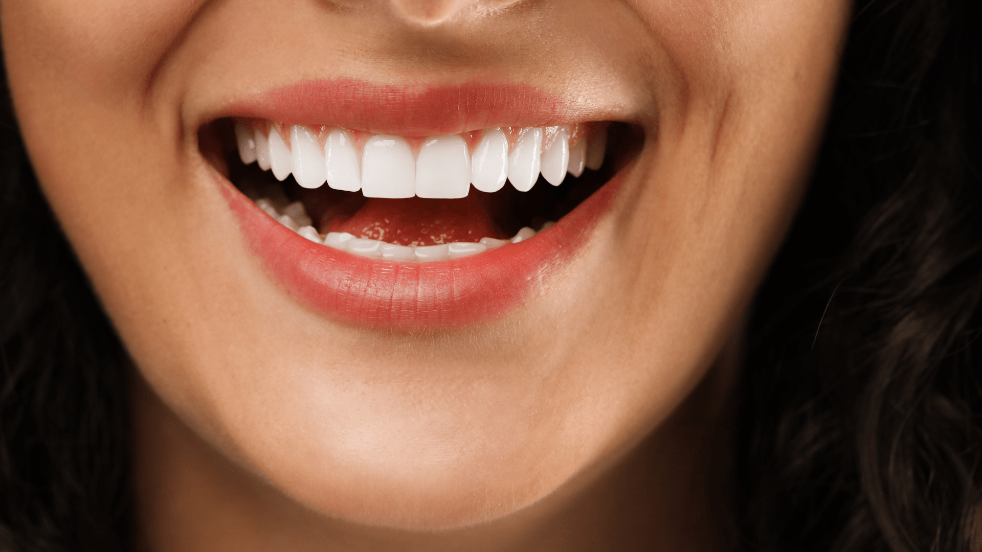 How Cosmetic Dentistry Transforms Confidence, Not Just Smiles