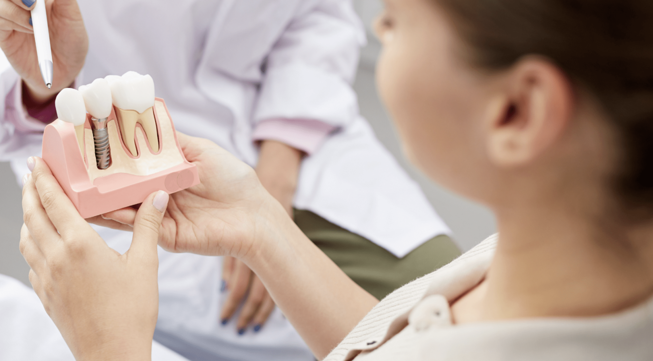 dental implants