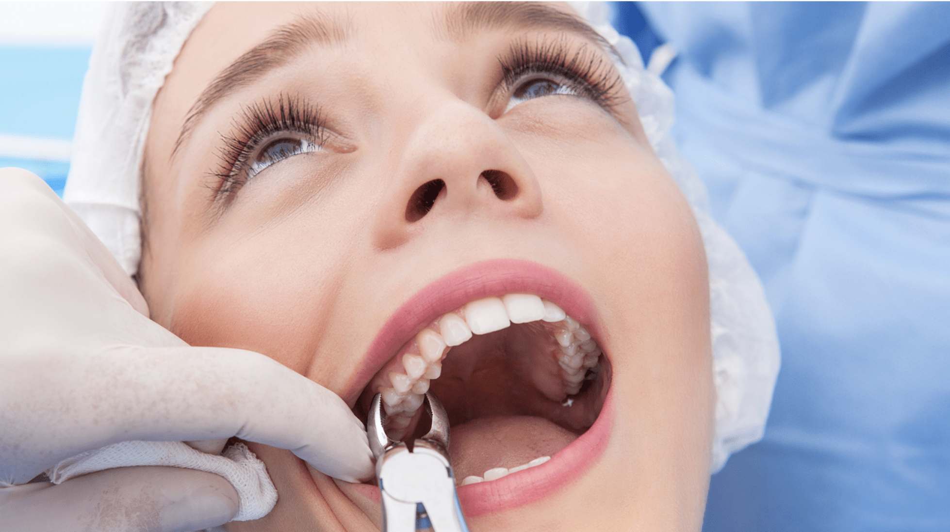 tooth extraction